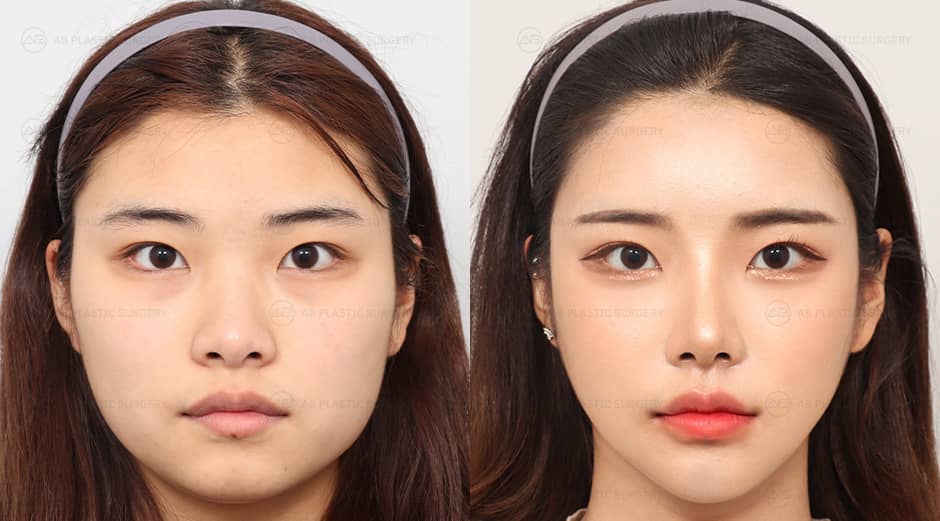 AB Plastic Surgery