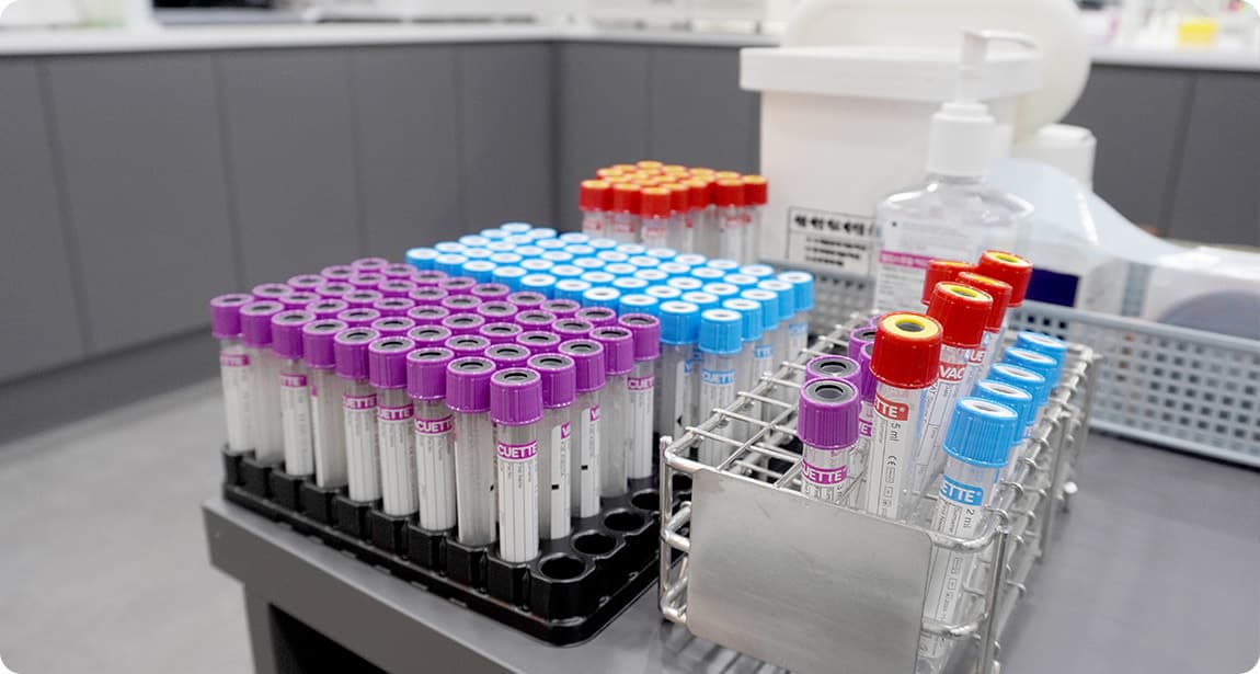 Lab ตรวจเลือด โรงพยาบาล AB