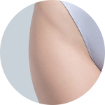 Liposuction result 5