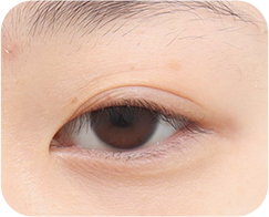 The Key to Beautiful Eyes