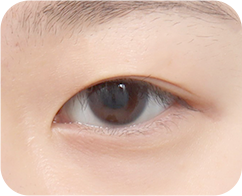 The Key to Beautiful Eyes