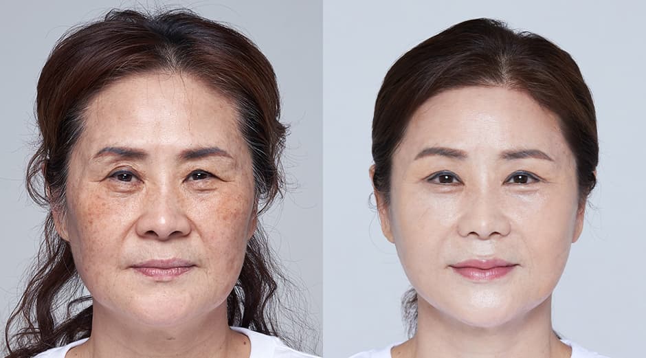 AB Plastic Surgery