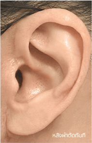 Skill matters in post-surgery scarring too. 2