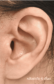 Skill matters in post-surgery scarring too. 3